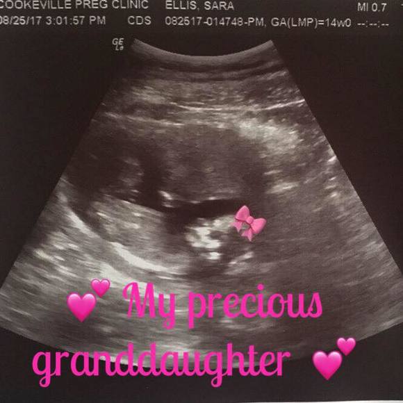 Meet your Posher, Robin - Picture 1 of 1